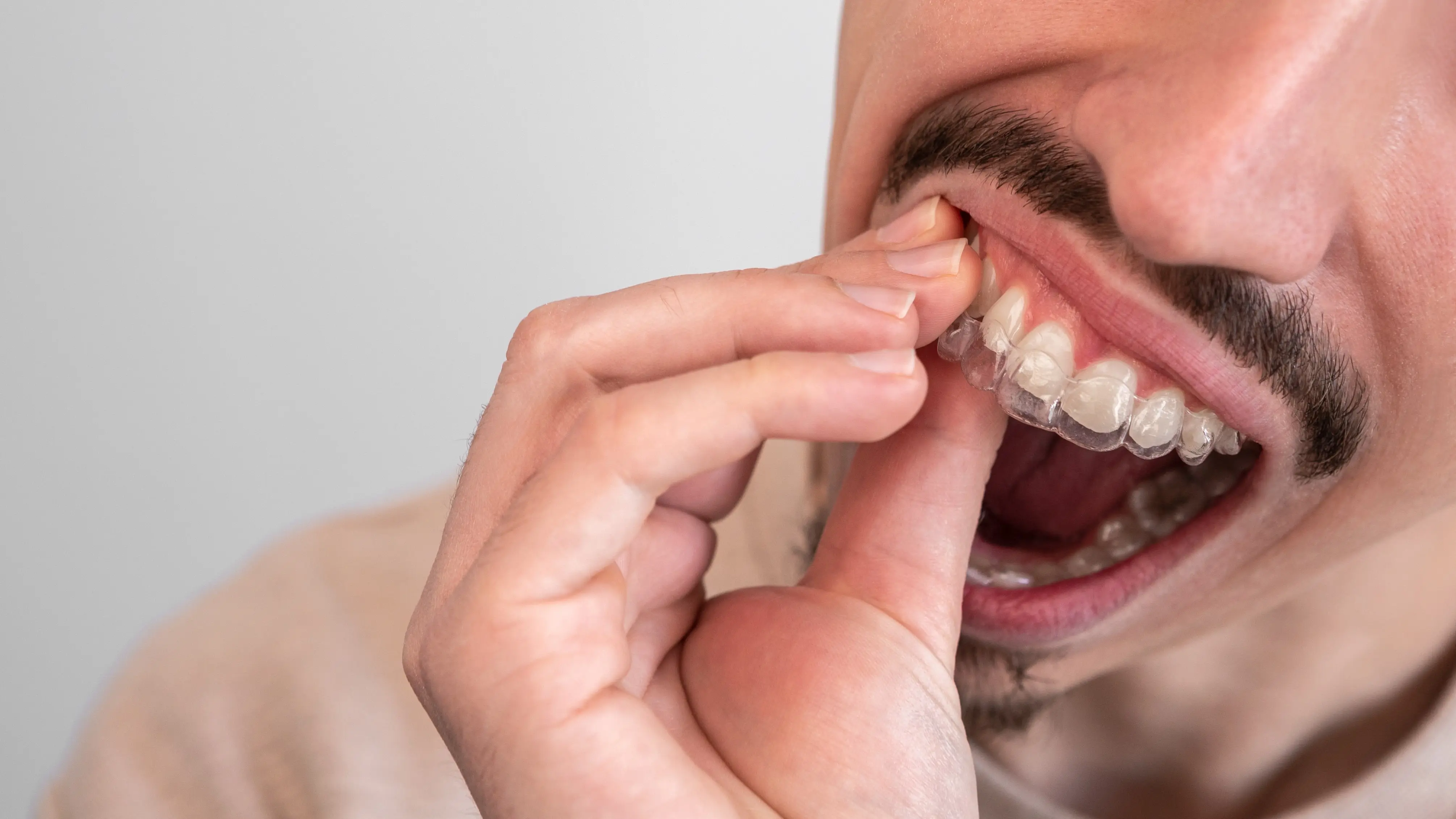 Can Invisalign Fix The Worst Teeth