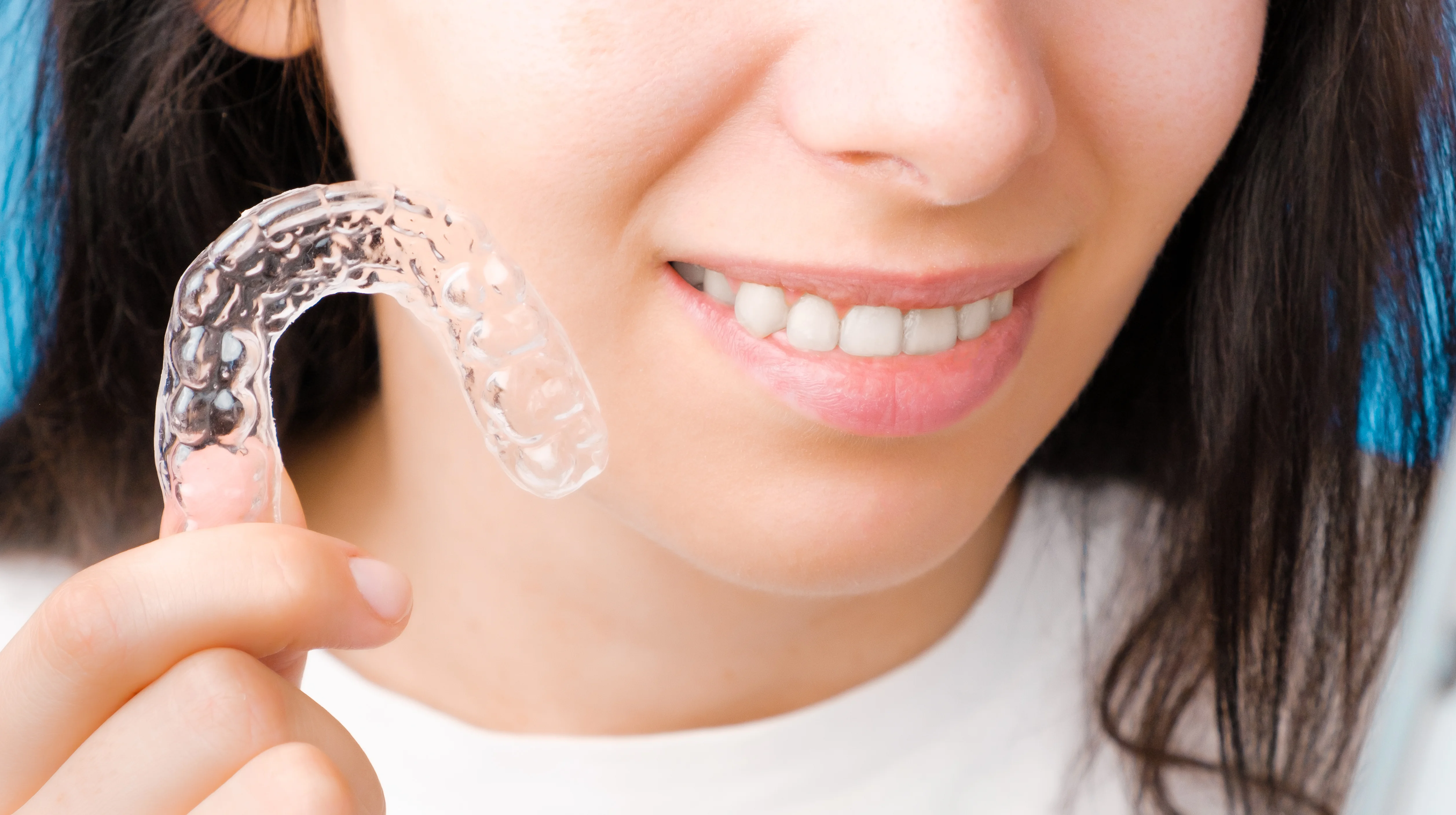 Does Invisalign Cost Less if Your Teeth Aren't Bad